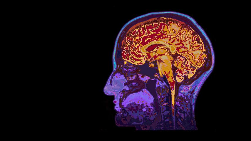 Low-intensity Ultrasound Can Change Decision-making Process In The ...